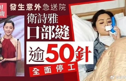 卫诗雅全面停工后，经纪公司英皇娱乐有何后续安排？
