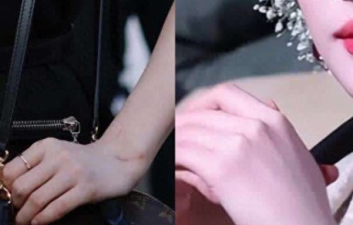 神仙姐姐也逃不过!刘亦菲手腕惊现血痕,网友:真·猫奴