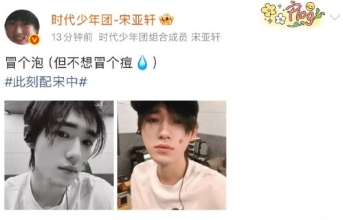 宋亚轩在抖音如何解释自己长胡子？