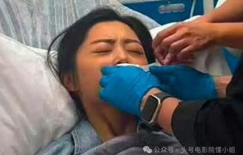 刚拿影后就毁容！41岁女星嘴缝50针，曾借钱搭车，16年龙套才熬出头