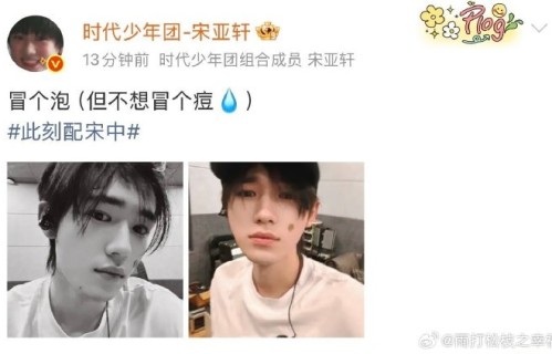 宋亚轩后续还会分享更多素颜照吗？